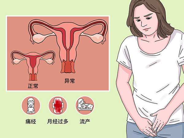 子宫异常患者不能吃大豆异黄酮