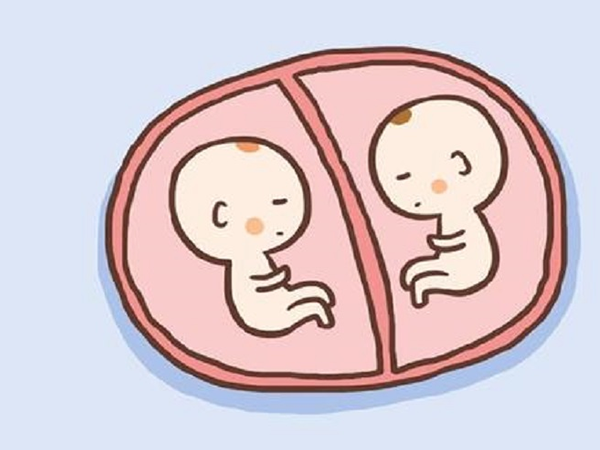 孕妇怀同卵双胞胎易出现高血压