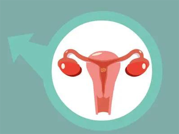 试管婴儿ppos方案适宜人群是哪些？卵子少、多囊卵巢均能做