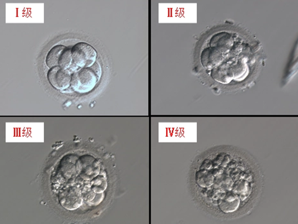 一般用A、B、C、D来表示胚胎等级