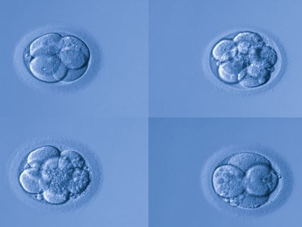 胚胎等级划分为I、II、III、IV级