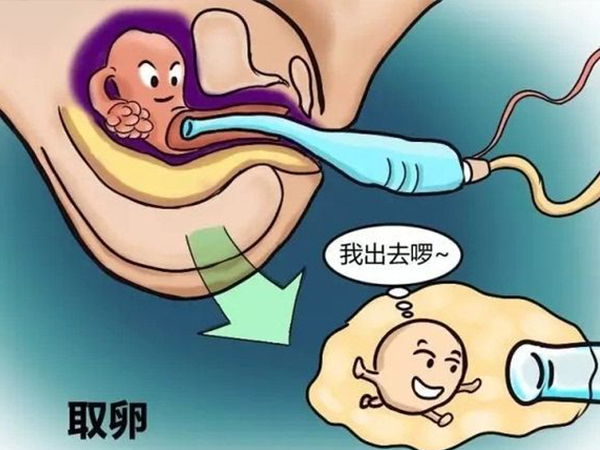 女性取卵子的过程是安全无痛的