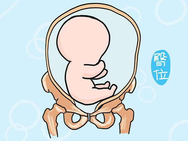 胎位不正不会使宝宝发育畸形