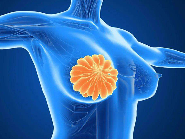 轻度乳腺增生纠正不良习惯可能会消失