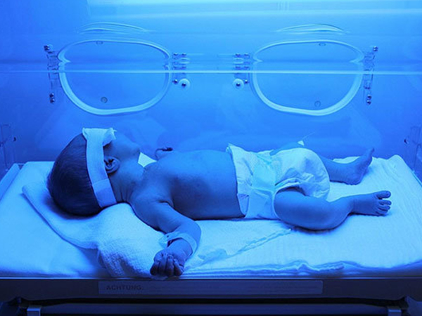 新生儿出生后黄疸高需及时照蓝光