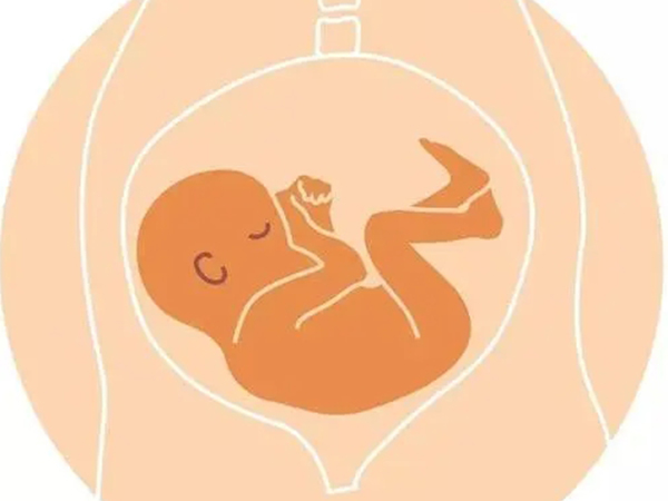 胎位不正会影响分娩