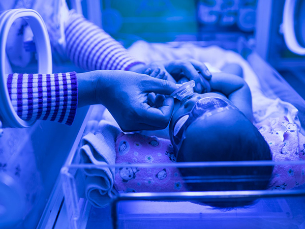 新生儿黄疸高蓝光治疗价格受医院影响
