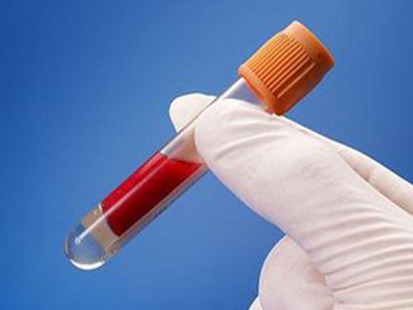 孕妇和男方血型不同生孩子需查溶血