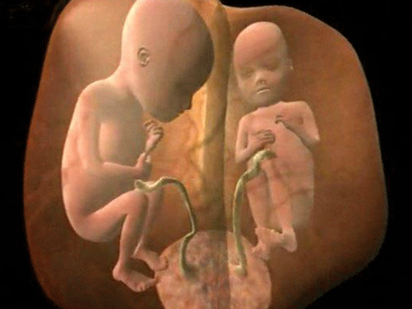 怀双胞胎能听到两个胎心