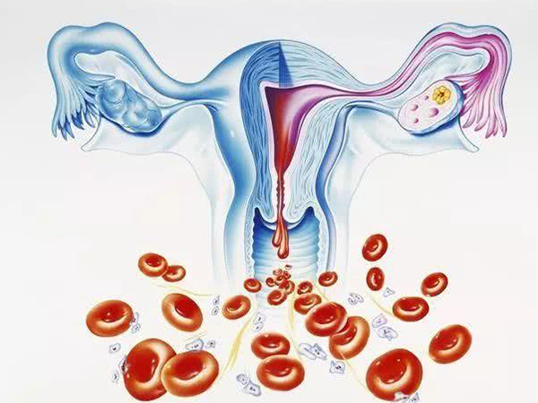卵巢病变会影响卵泡发育