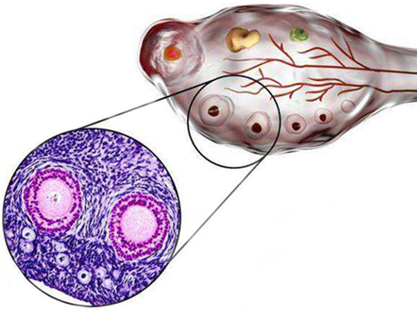 人授前要监测卵泡