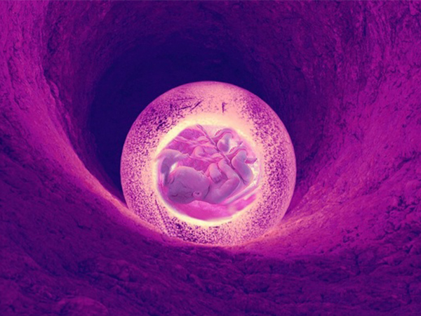 子宫畸形不适合移植两个胚胎