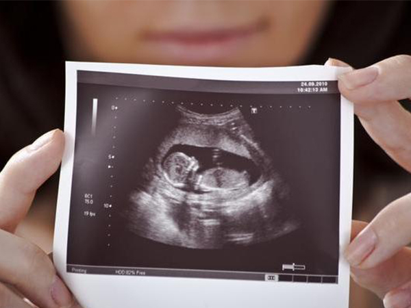 14周女孩胎儿图图片