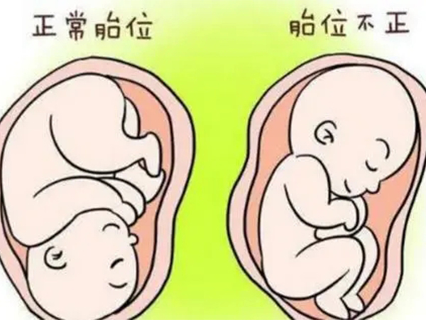 胎儿头位lot图片图片