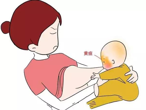 母乳性黄疸指数小于15