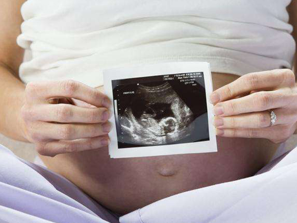 孕35天b超图有双孕囊是双胞胎