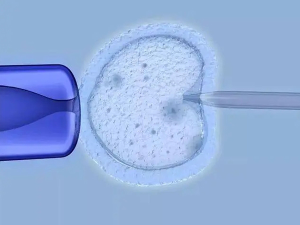 拮抗剂方案能预防卵巢过度刺激