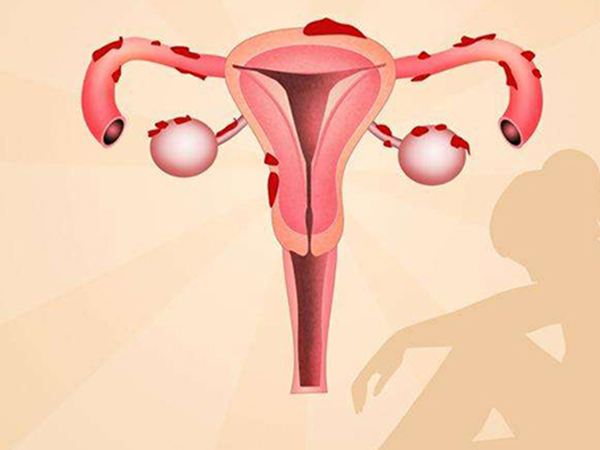 摘除子宫会对女性生育有影响