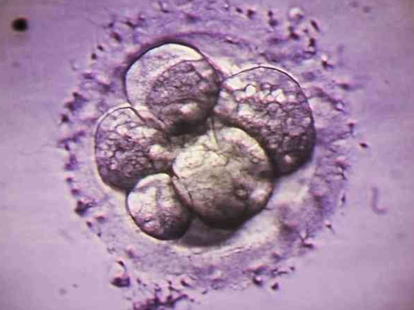 囊胚5bb相当于一级的优质囊胚