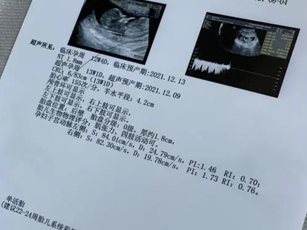nt是对胎儿染色体情况的筛查