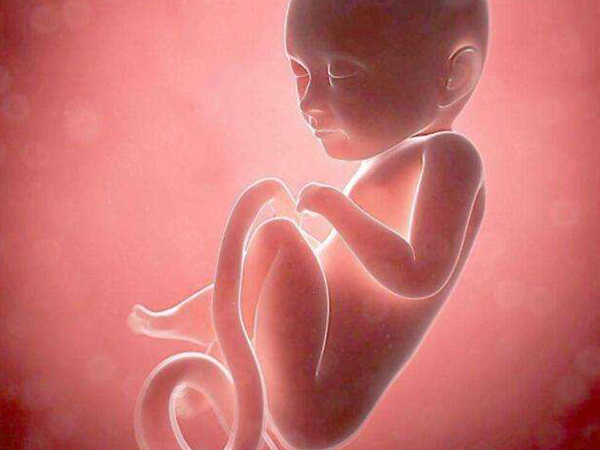 胎儿畸形会导致羊水异常