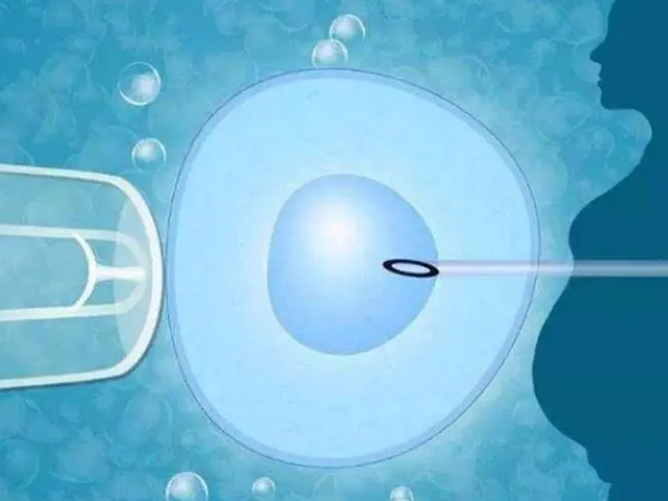 一代试管的精子和卵子是自由结合