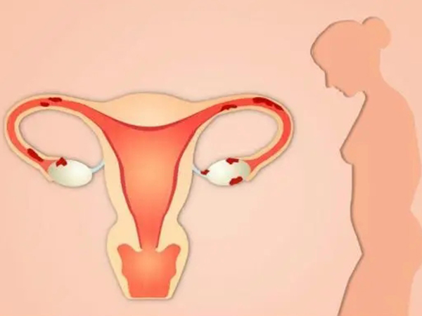 人工授精在女性排卵期进行