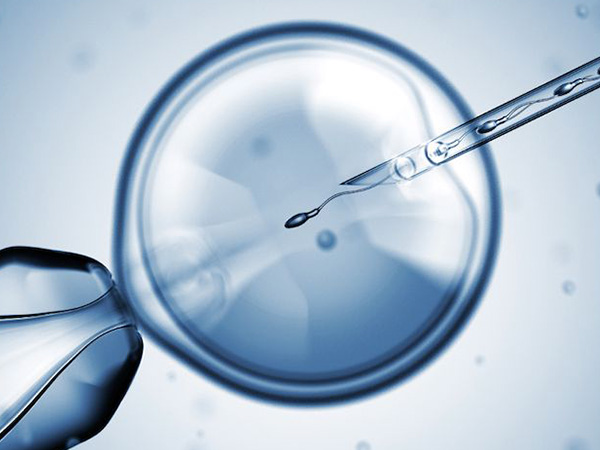 精子导致的不孕症通常采用二代试管