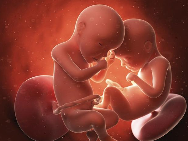 做试管婴儿怀上单卵双胎的人都是卵子质量很好吗?