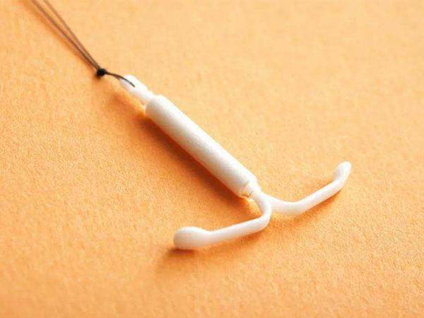 节育环是一种避孕工具