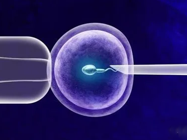 胚胎移植时速度过快会宫外孕