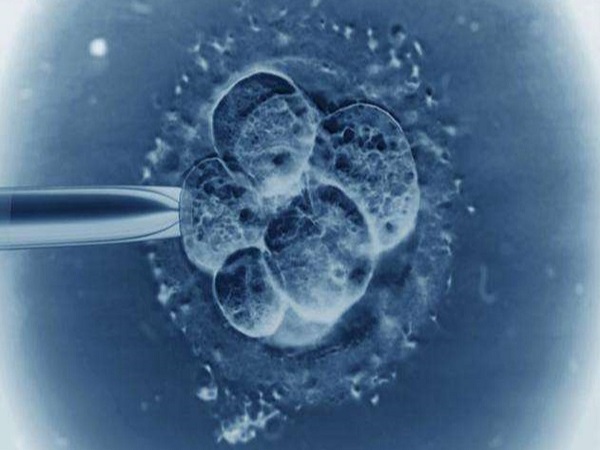 自然周期冷冻胚胎移植的流程