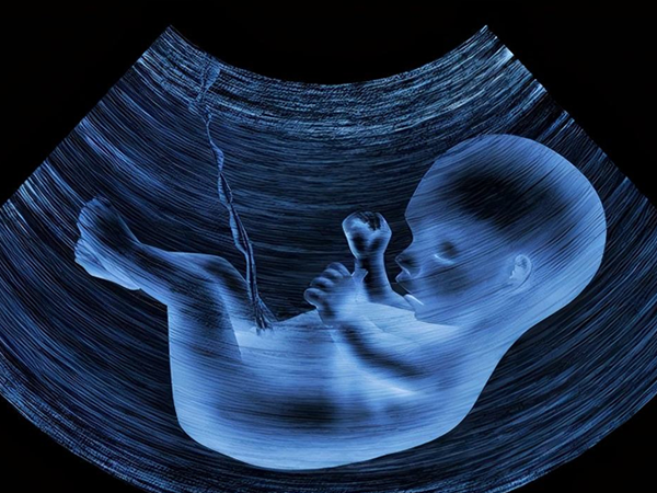 怀孕2周彩超图图片