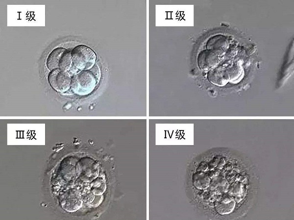 一级二级三级四级胚胎的形态图