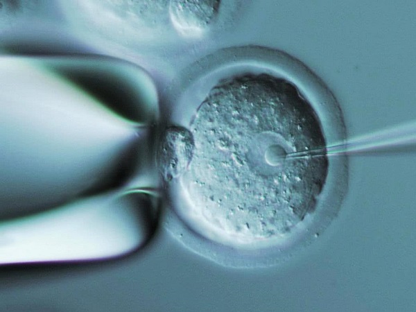 试管移植成功率受胚胎质量影响