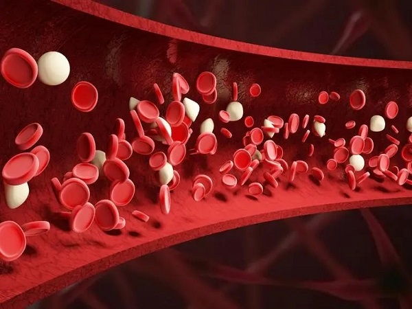 溶血是一种常见的新生儿疾病