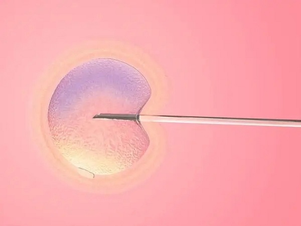 胚胎移植是试管中的关键一步