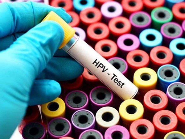 hpv病毒检测需要结合多项检查
