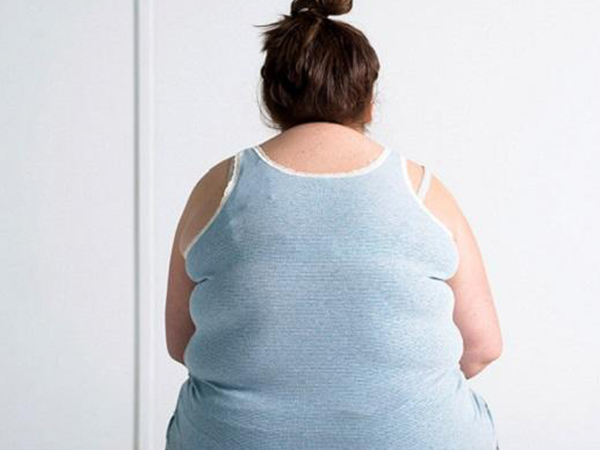 重度多囊会导致身体发胖