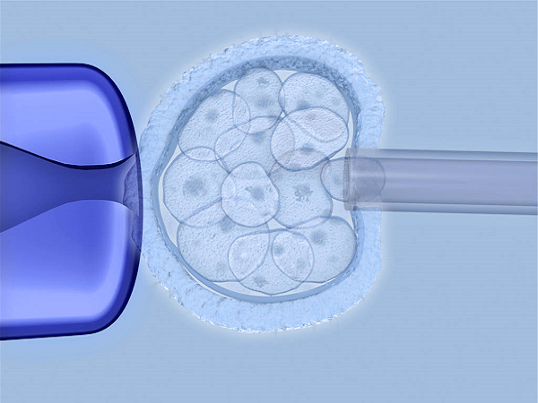 胚胎移植是试管中最重要的一步