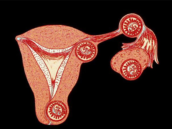 卵巢早衰会导致不孕不育