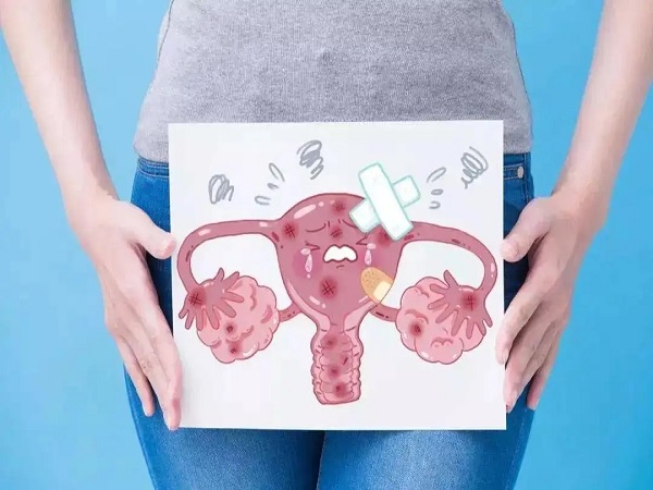 卵巢早衰是常见的妇科疾病