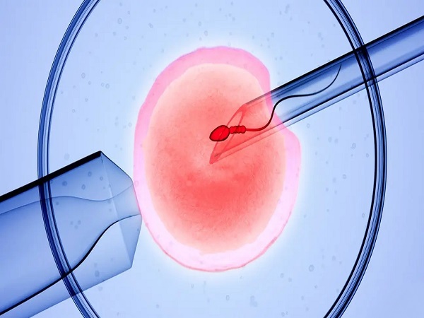 供卵试管是辅助生殖技术的一种