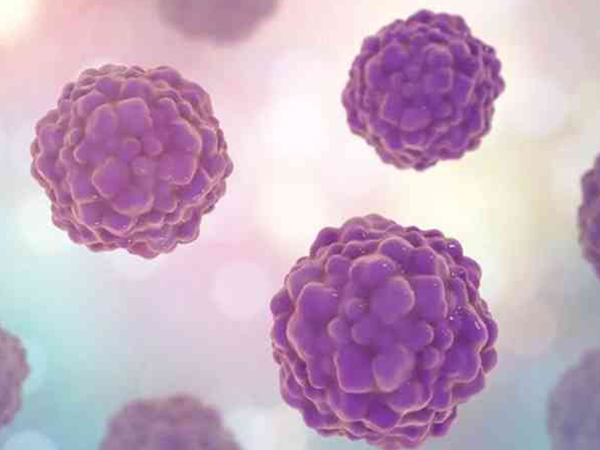 HPV16阳性不一定患宫颈癌