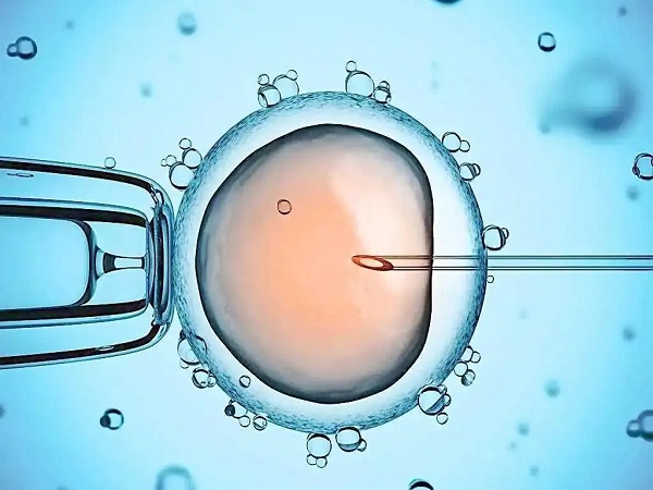 胚胎移植是试管非常关键的一步