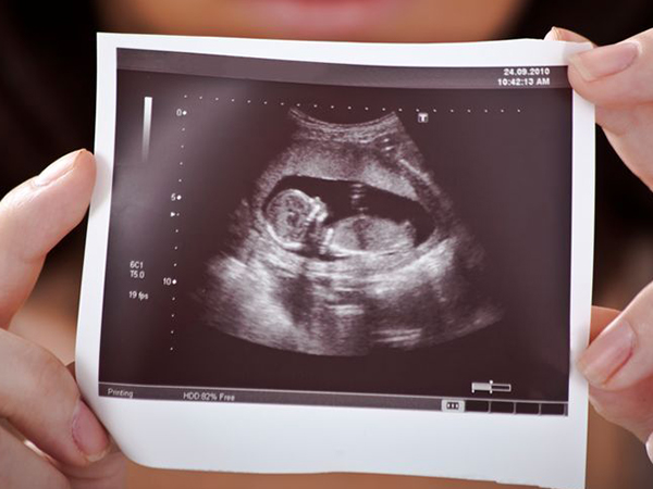 3个月胎儿彩超 男女图片