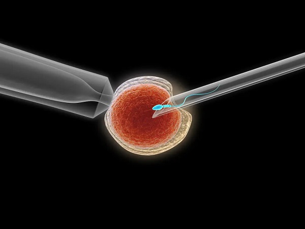 供卵试管也是辅助生殖中的一种