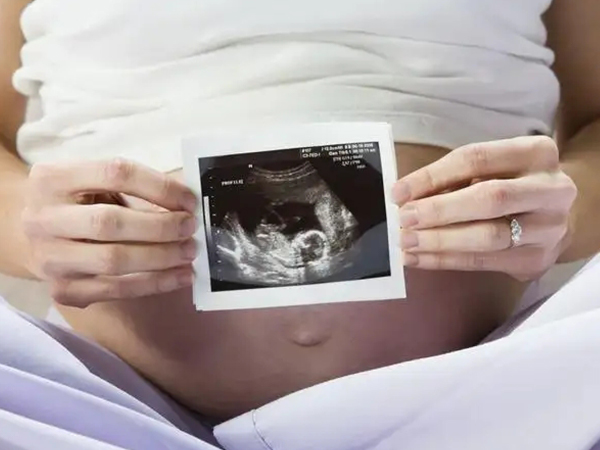 公立医院做三维就可筛查大部分胎儿畸形
