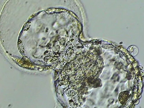 囊胚性别由精子染色体所决定