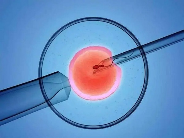 试管婴儿是目前最先进的辅助生殖技术